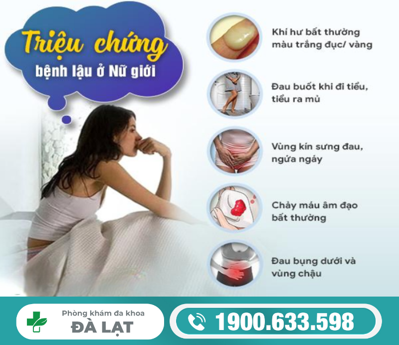Hình ảnh minh họa